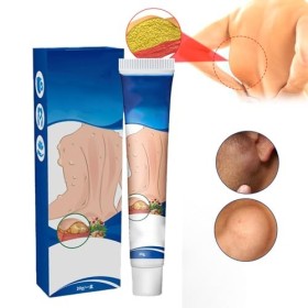 Lipoma Removal Cream,Crème Délimination Des Lipomes,Pommade Apaisante pour Les Lipomes,Pommade de Suppression sûre à Utilise