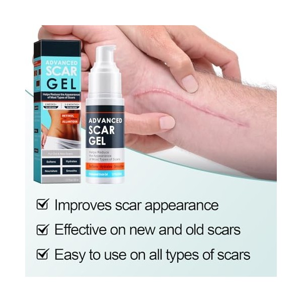 Apooliy Gel pour cicatrices, crème pour lélimination des cicatrices de vergetures, cicatrices chirurgicales, chéloïdes, acné