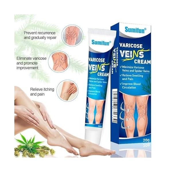 Traitement des varices des jambes, crème variqueuse, soulagement des varices, veines daraignée, 20g
