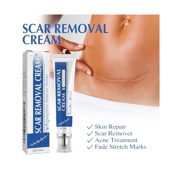 Élimination Des Cicatrices,Crème pour Eliminer les Cicatrices,Gel de Cicatrice en Silicone,Crème Anti-Cicatrices pour le Visa