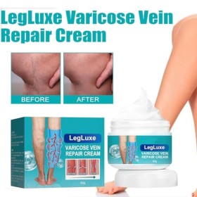 Crème pour Varices,Crème Soin Des Jambes,Réparation Des Jambes DAraignée,Crème Contre Les Varicosités,Creme Anti Varices Crè