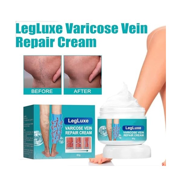Crème pour Varices,Crème Soin Des Jambes,Réparation Des Jambes DAraignée,Crème Contre Les Varicosités,Creme Anti Varices Crè