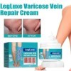 Crème pour Varices,Crème Soin Des Jambes,Réparation Des Jambes DAraignée,Crème Contre Les Varicosités,Creme Anti Varices Crè