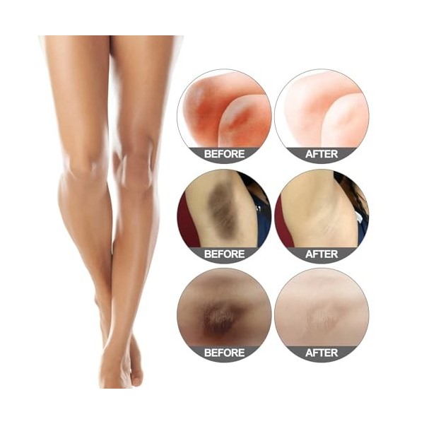 Mikabila 01 30g Crème de Blanchiment des Articulations Foncées,Crème Eclaircissante, Crème Blanchissante Pour Les Aisselles,