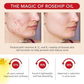 Huile de Rose Musquée Bio,100ML,Huile Rose Musquée Bio pour Les Visage Cheveux Hydrates Corps Peau Pieds et Ongles,Naturelle 