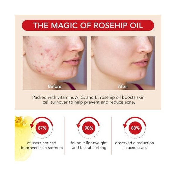 Huile de Rose Musquée Bio,100ML,Huile Rose Musquée Bio pour Les Visage Cheveux Hydrates Corps Peau Pieds et Ongles,Naturelle 