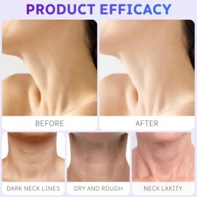 LOPHE Crème Raffermissante Cou et Décolleté, Hydratante Anti-âge pour le Cou Crème Relachement Cou pour Resserrer la Peau Aff