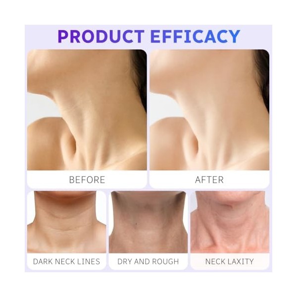 LOPHE Crème Raffermissante Cou et Décolleté, Hydratante Anti-âge pour le Cou Crème Relachement Cou pour Resserrer la Peau Aff