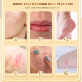 Rostblant Baume à lèvres à la papaye, pommade naturelle à la papaye, baume à lèvres nourrissant, crème réparatrice à la papay