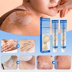 MINGRUO 2Pcs Vitiligo Cream, Vitiligo Pommade, Crème De Soin Des Points De Fleurs, Crème pour la Peau Vitiligo, Crème De Soin