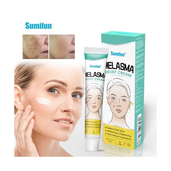 Crème taches de rousseur, crème de traitement délimination des cicatrices dacné, crème dépigmentante pour le visage, crème 