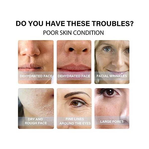 Hydrolyzed Collagène Protein Line Lifting Instantané de la protéine fil de protéines solubles et combinaison de sérum dor, F