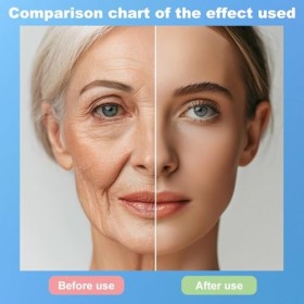Collagène Visage Sérum,Sérum Anti-Rides Anti-Age,Sérum Visage,Hyaluronique Serum Visage,Sérum Correcteur de Taches,Sérum Anti