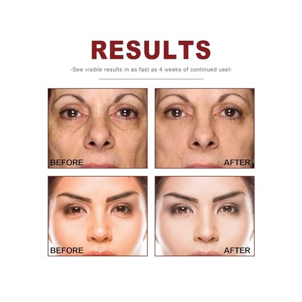 Sérum Visage Rétinol 30ml,Retinol Serum Visage,Sérum Anti-âge Anti-rides,Sérum Visage au Rétinol,Retinol Sérum pour le Visage