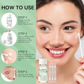 LANBENA Sérum de précision contre lacné, lotion asséchante contre lacné, traitement de nuit contre lacné pour le visage, a