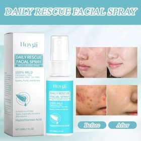 2 Pcs Spray dacide hypochloreux,Spray dacide hypochloreux pour le visage,Spray dacide hypochloreux pour le visage et la pe