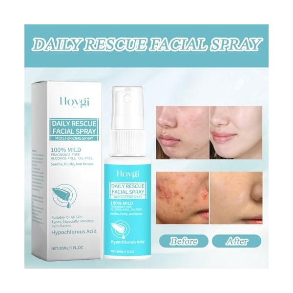 2 Pcs Spray dacide hypochloreux,Spray dacide hypochloreux pour le visage,Spray dacide hypochloreux pour le visage et la pe