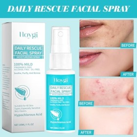 Spray acide hypochloreux, spray acide hypochloreux, 24 nouvel acide hypochloreux, hydratant, protection antioxydante, facile 