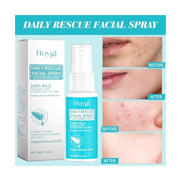 Spray acide hypochloreux, spray acide hypochloreux, 24 nouvel acide hypochloreux, hydratant, protection antioxydante, facile 