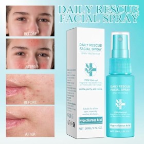 Spray dacide hypochloreux, spray facial à lacide hypochloreux, spray facial apaisant et hydratant, peut être utilisé pour l