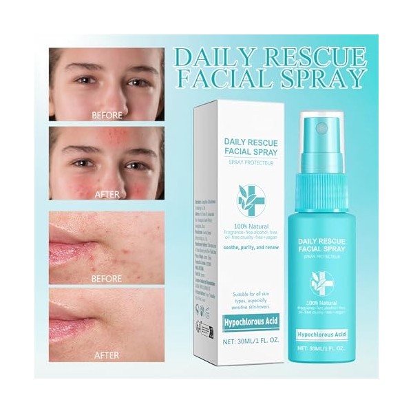 Spray dacide hypochloreux, spray facial à lacide hypochloreux, spray facial apaisant et hydratant, peut être utilisé pour l