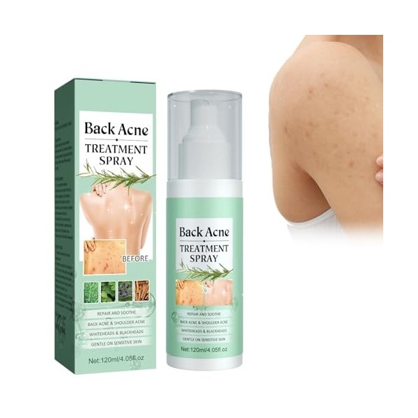 Spray Contre lacné du Dos, Spray de Traitement de lacné pour le Dos et lacné, Spray pour le dos et le Corps, Éclaircir les