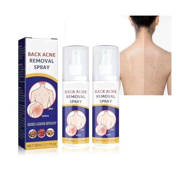 Pemarlis 2pcs*60ml Spray de traitement de lacné du dos, Exfoliant pour le dos,nettoyage en profondeur,Éclaircir les marques 