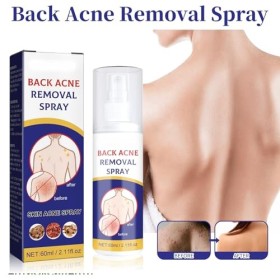Pemarlis 2pcs*60ml Spray de traitement de lacné du dos, Exfoliant pour le dos,nettoyage en profondeur,Éclaircir les marques 