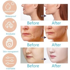 Fengyang® Autocollant Lifting Visage Tape, Tape Face Lift, Patchs De Levage De Visage Invisibles, Ensemble De Patchs Aminciss