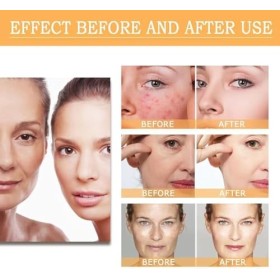 Glycolic Acid 7% Toning Solution,Acide Glycolique 7% Tonique,240 ml Moisturising Face Toner,Glycolic Acid Serum Essence,Glyco