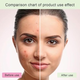 Glycolic Acid 7% Toning Solution,Acide Glycolique 7% Tonique,Moisturising Face Toner,Glycolic Acid Serum Essence,Glycolic Aci