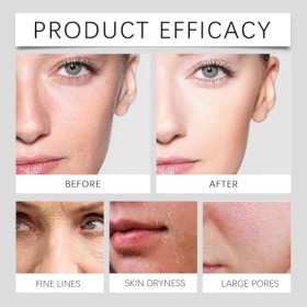 Soothing Toner, 100 ml, tonique apaisant pour la peau, essence rafraîchissante, essence hydratante et apaisante, tonique quot