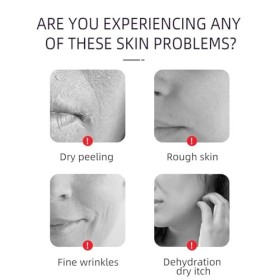 Tkekruh 40pc Tampons à lacide Kojique et au Curcuma et 100ml Turmeric Toner au Curcuma, Combat LAcné, Estomper les Marques 