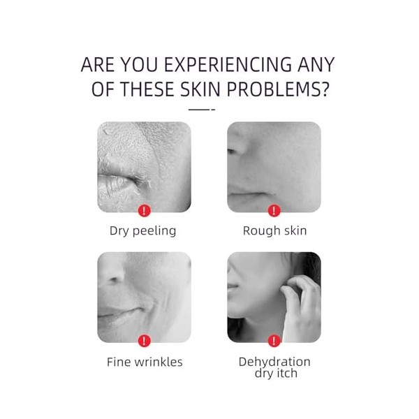 Tkekruh 40pc Tampons à lacide Kojique et au Curcuma et 100ml Turmeric Toner au Curcuma, Combat LAcné, Estomper les Marques 