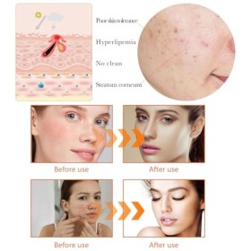 Turmeric Toner au Curcuma,Turmeric Serum Visage Anti Tache,Lexfoliant Facial Hydratant,Tonique Exfoliant pour le Visage,Toni