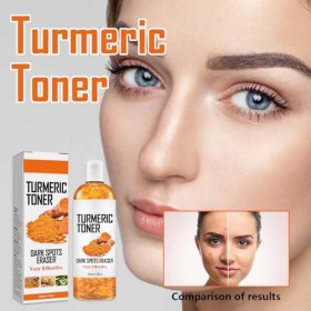 Cotensta 2 Pièces de Toner au Curcuma, Toner au Turmeric pour la Protection et lhydratation de la Peau, Lotion Tonique Anti-