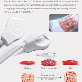 Machine De Sculpture Musculaire Amincissante pour Le Corps, Renforcement Musculaire Magnétique Portable EMS avec 1 Poignée, É