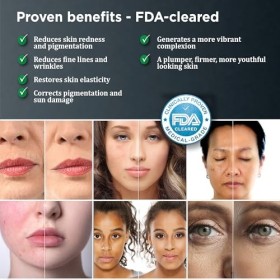 mypurskin Masque professionnel de thérapie par lumière rouge