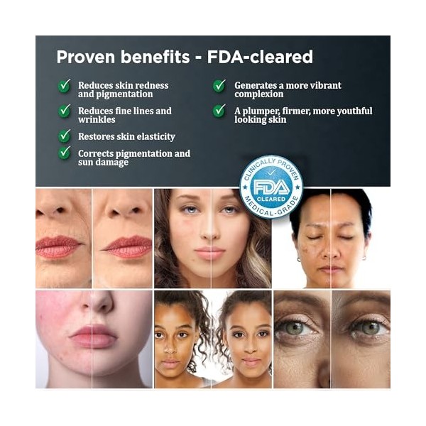 mypurskin Masque professionnel de thérapie par lumière rouge