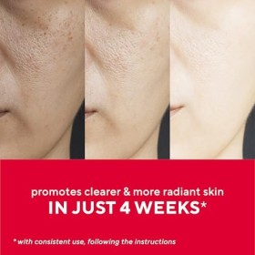 Mirabella Masque de luminothérapie à DEL 7 couleurs pour le visage avec lumière proche infrarouge – Sans fil, rechargeable, m