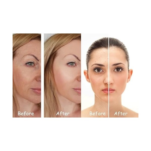 Masque de Luminothérapie LED DELULIGHT - 99 LED, 7 Couleurs, Anti-Âge, Anti-Acné, Améliore lÉlasticité de la Peau, Réduit le