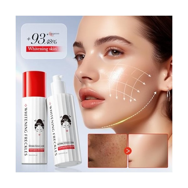 Rostblant Crème anti-imperfections, Crème anti-taches, Crème de traitement du visage pour les femmes, Crème hydratante pour l