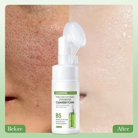 Rostblant Mousse nettoyante pour le visage, mousse de traitement pour le visage, mousse nettoyante hydratante pour le visage 