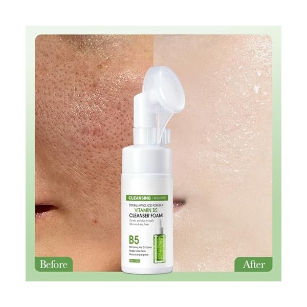 Rostblant Mousse nettoyante pour le visage, mousse de traitement pour le visage, mousse nettoyante hydratante pour le visage 