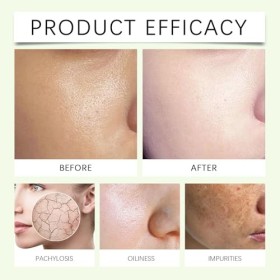 Nettoyant doux pour le visage - 100 ml - Crème nettoyante quotidienne - Nettoyant exfoliant pour tous les types de peau - Mou