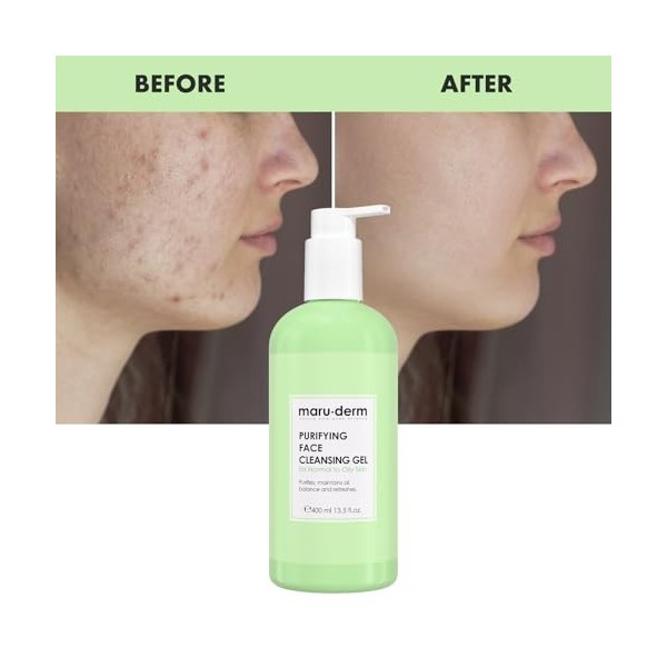 Maruderm Gel Nettoyant Visage à Lacide Salicylique Spécialement Conçu pour Les Peaux Mixtes et Grasses 400 ML