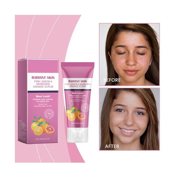 Gel Peeling Exfoliant Éclaircissant, Gommage Corporel Éclaircissant, Gel Exfoliant Visage Et Corps, Gel Exfoliant éclaircissa