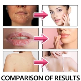 Tkekruh Gommage Visage 100g,Skin Detox Peau Soin Exfoliant, Deep Cleanse, Éclaircissant Doux Éclaircissant Points Noirs Tache