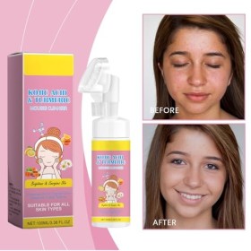 Grgowe 2Pc Nettoyant Moussant Au Curcuma,Nettoyant Visage Au Curcuma Et à LAcide Kojique,Nettoyant Visage à lAcide Kojique,