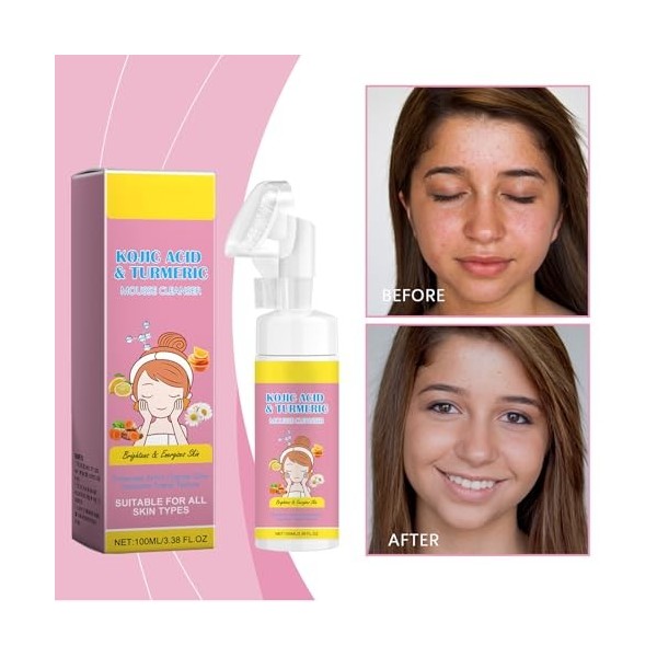 Grgowe 2Pc Nettoyant Moussant Au Curcuma,Nettoyant Visage Au Curcuma Et à LAcide Kojique,Nettoyant Visage à lAcide Kojique,